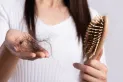 ¿Pérdida de cabello? Qué afección se esconde detrás de este síntoma que ataca principalmente a mujeres