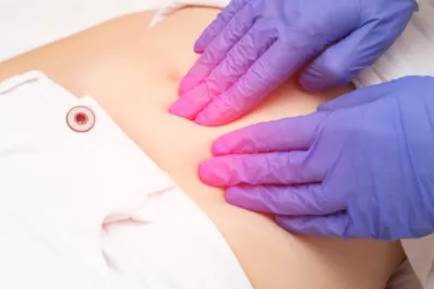 ¿Por qué se confunde el cáncer de ovarios con gases? Síntomas y formas de detectarlo