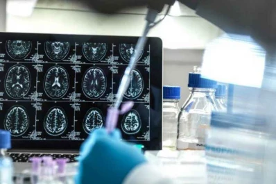 Urge tener un plan ante el aumento de casos de Alzheimer