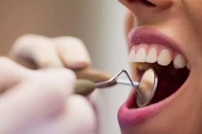 ¿Cuál es la fruta que ayuda a eliminar el sarro de los dientes en un simple paso?