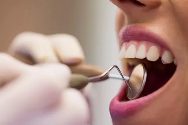 ¿Cuál es la fruta que ayuda a eliminar el sarro de los dientes en un simple paso?