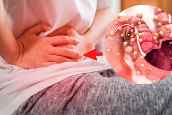 El alimento que podría elevar el riesgo de cáncer de colon y muchos consumen a diario