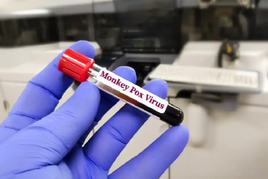 imagen tomada de https://www.freepik.es/fotos