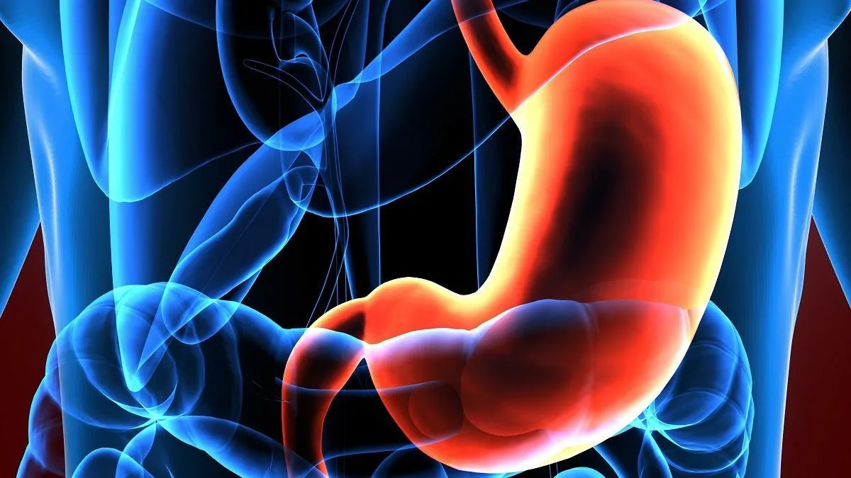 ¿Cómo se relacionan la sal y el cáncer de estómago?