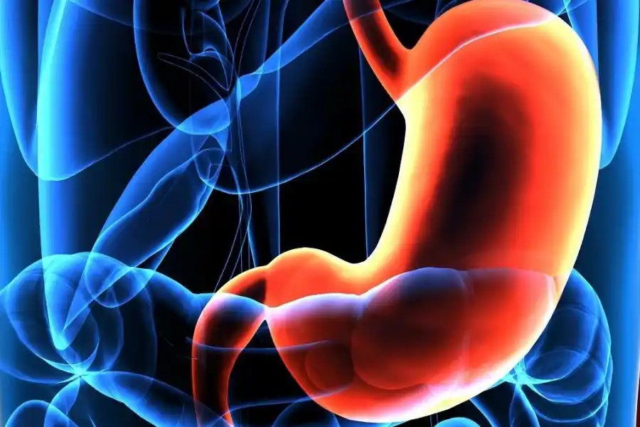 ¿Cómo se relacionan la sal y el cáncer de estómago?