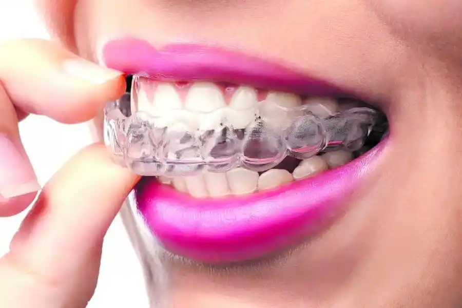 CÓMO TRATARLO. Las placas de relajación son una de las formas más comunes de tratamiento para un mejor despertar por las mañanas.