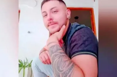 Murió un argentino que había contraído viruela del mono en México