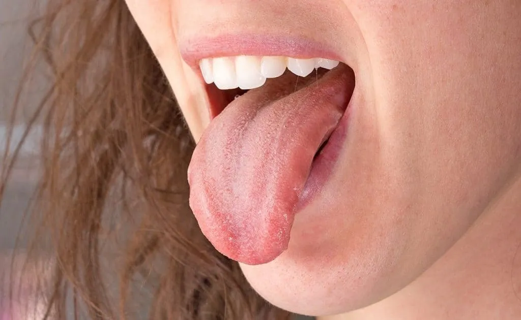 Estos son los colores de la lengua que pueden indicar problemas de salud, según la ciencia