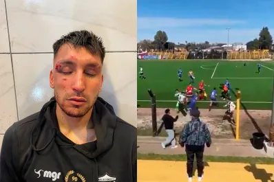 Jugadores en el hospital y un periodista agredido, el saldo de una batalla campal en el ascenso uruguayo