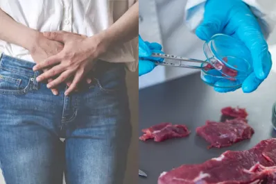 Salud: por qué consumir más carne puede aumentar la probabilidad de tener infecciones urinarias