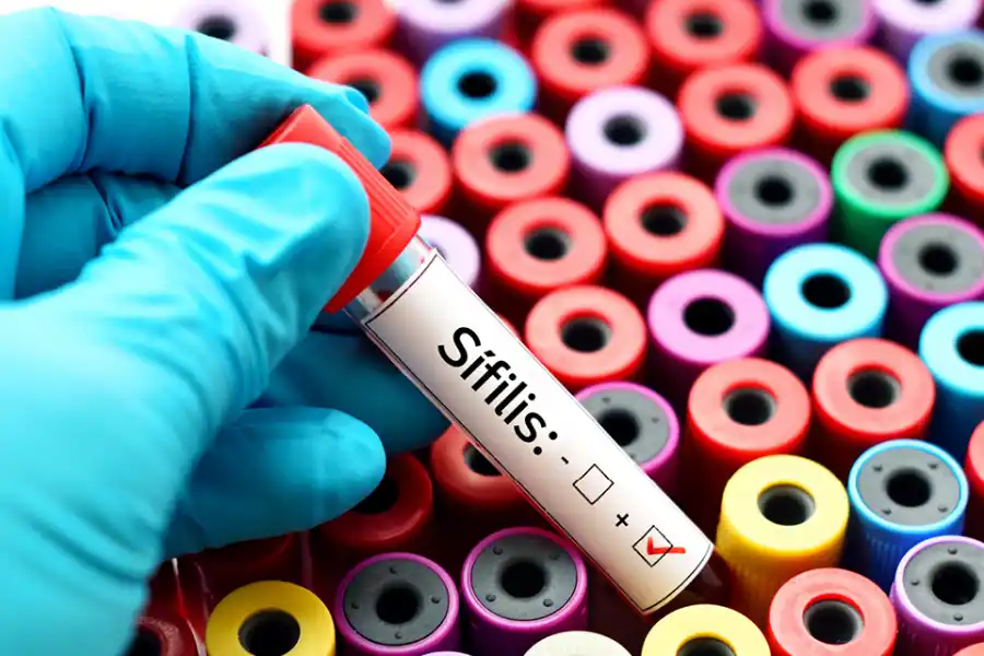 TEST. Los estudios se realizan en todos los hospitales de la provincia.