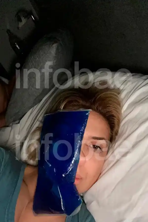 Las nuevas fotos que aportó la querella donde se ve a Fabiola Yáñez con moretones en la cara