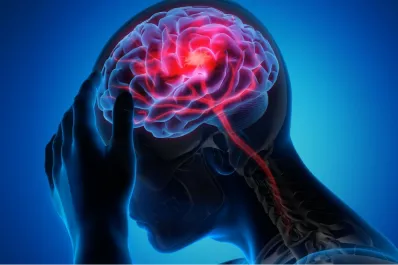 ACV: cómo reconocer sus síntomas a tiempo y evitar secuelas graves