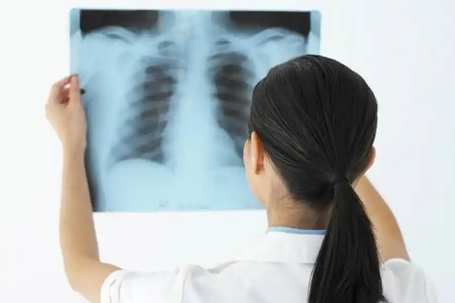 UN GRAVE PROBLEMA. Las afecciones respiratorias causan decesos. archivo