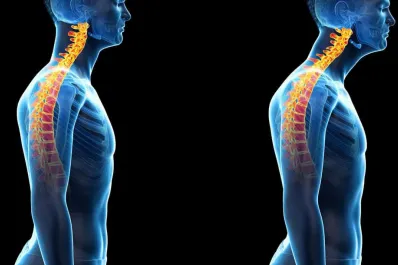 Por qué la mala postura puede afectar a nuestra salud mental, según la ciencia