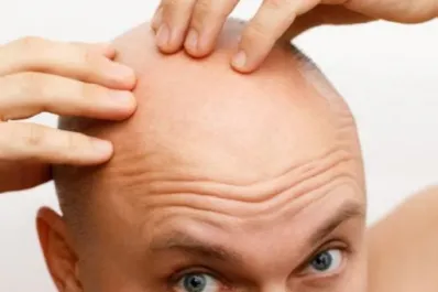 Día del Pelado: la historia detrás de la curiosa fecha que se celebra cada 7 de octubre