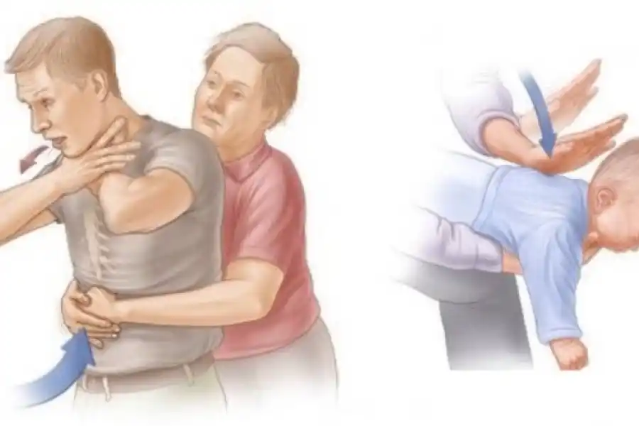 Las diferencias de la técnica en un bebé y en un adulto.