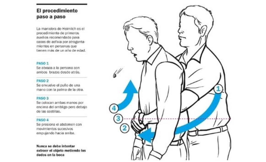 Cómo hacer la maniobra de Heimlich