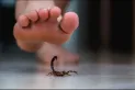 Si te pica un alacrán, esto tenés hacer antes de acudir a un hospital