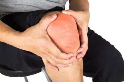 La hierba que genera colágeno y alivia los dolores de rodilla