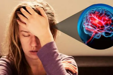 ¿Cómo saber si un dolor de cabeza es señal de un derrame cerebral?