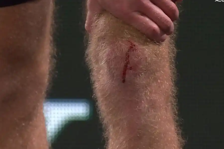 La insólita auto agresión del rival de Francisco Cerúndolo en París