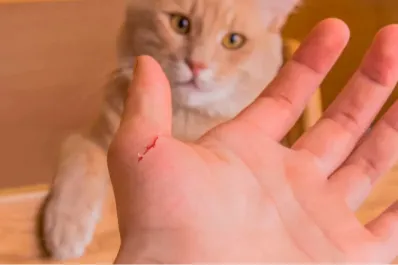 Con un simple arañazo, estas son las enfermedades que puede transmitir un gato