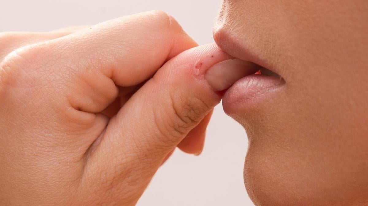 Cuáles son los síntomas de la "sepsis", la mortal infección que se origina por morderse las uñas