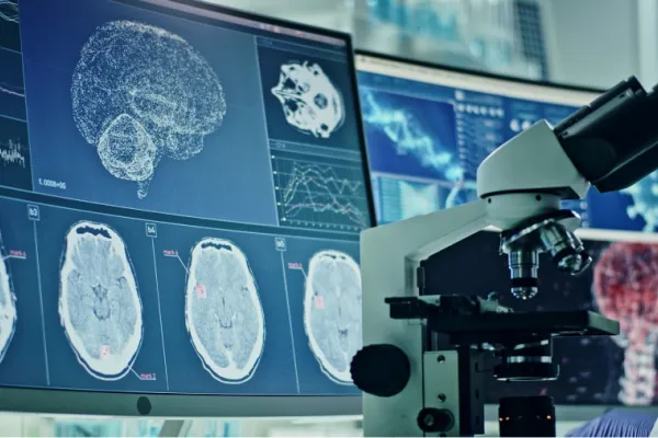 600x400_neuronas-no-son-unicas-celulas-cuerpo-capaces-almacenar-informacion-1061674-113507.webp