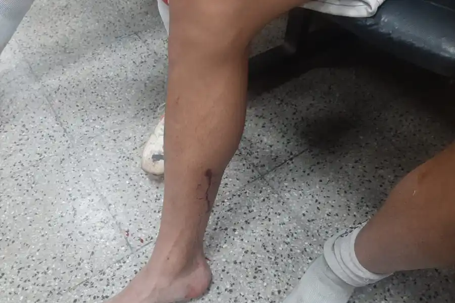 Sportivo Guzmán-Atlético Concepción: invasión de campo de juego y salvaje agresión a los jugadores del Juliano