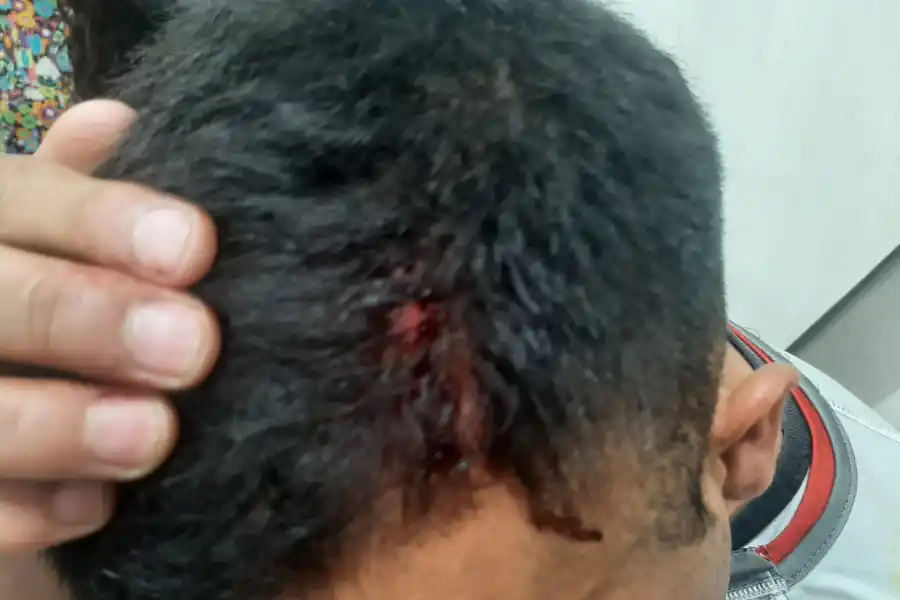 Sportivo Guzmán-Atlético Concepción: invasión de campo de juego y salvaje agresión a los jugadores del Juliano