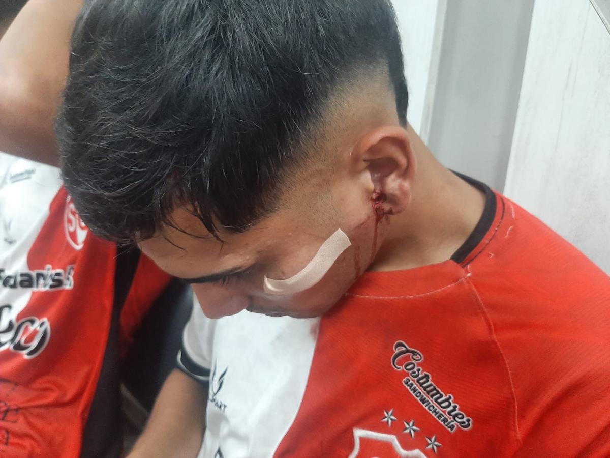 Otra vez la violencia le ganó al fútbol: graves incidentes en el duelo que Sportivo eliminó a Atlético Concepción