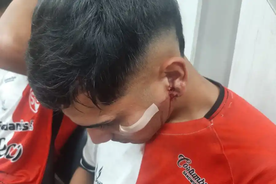 La Policía, sobre la agresión a los jugadores de Sportivo Guzmán: Nos vimos rebasados