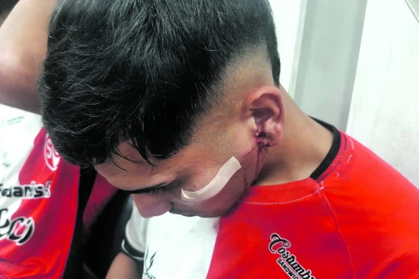 “Pensé que no iba a ver más a mi familia”, dijo un jugador de Sportivo Guzmán atacado por la hinchada de Atlético Concepción