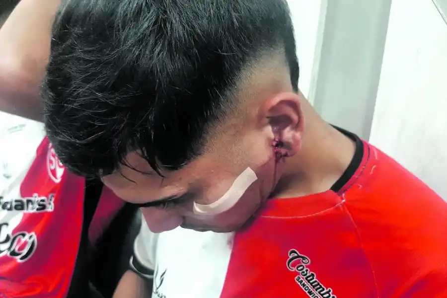 AGRESIONES. Las fotos muestran las secuelas que dejó la violencia que desataron hinchas de Atlético Concepción sobre jugadores de Sportivo Guzmán.