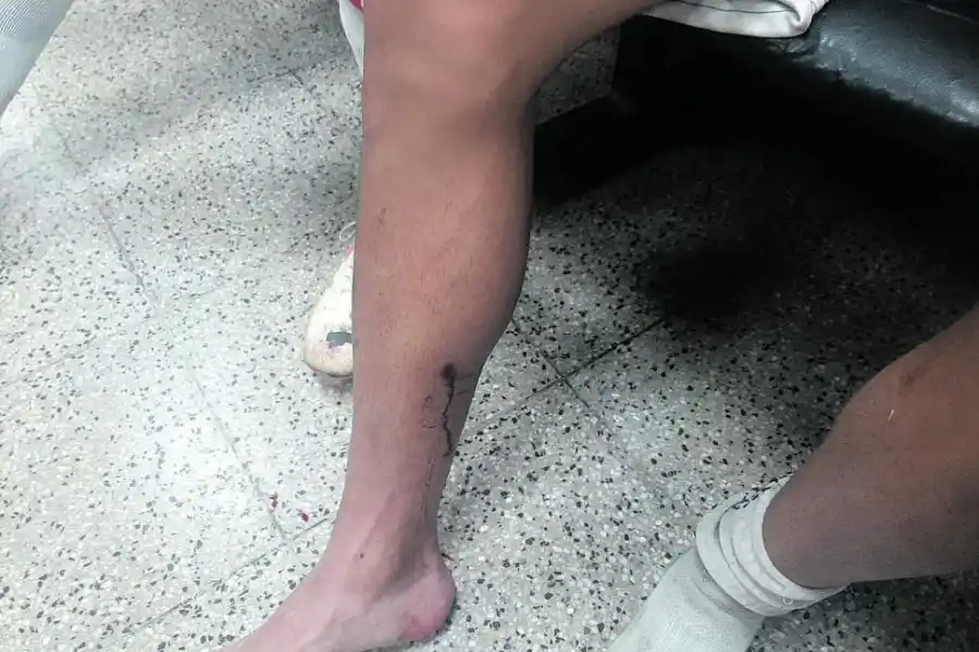 “Pensé que no iba a ver más a mi familia”, dijo un jugador de Sportivo Guzmán atacado por la hinchada de Atlético Concepción