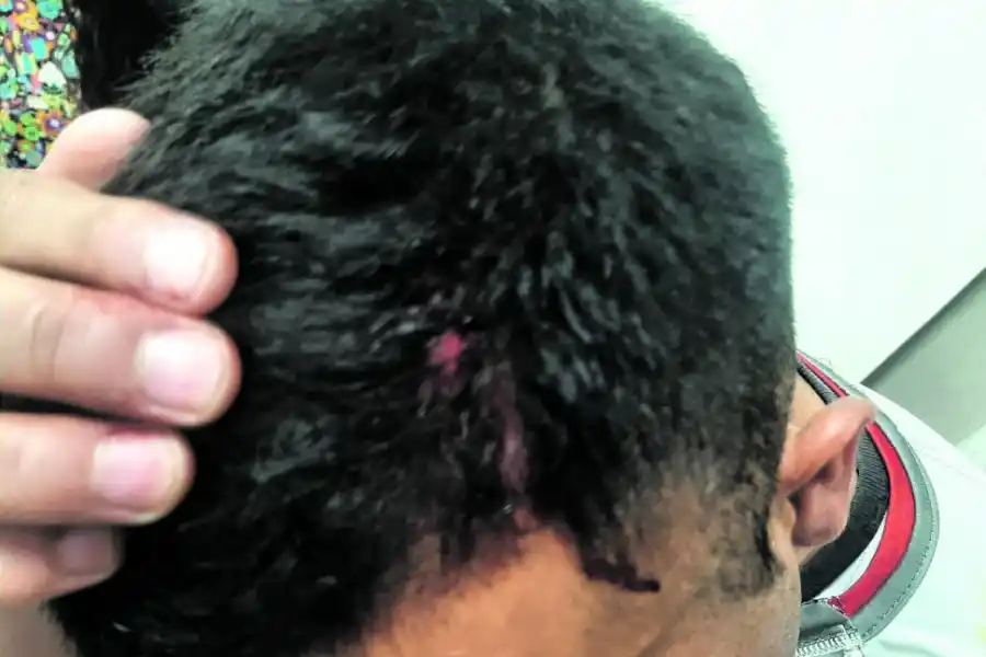 “Pensé que no iba a ver más a mi familia”, dijo un jugador de Sportivo Guzmán atacado por la hinchada de Atlético Concepción