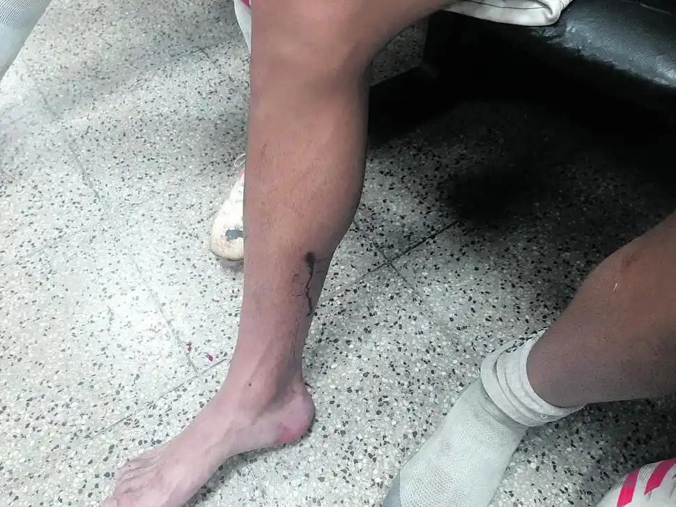 “Pensé que no iba a ver más a mi familia”, dijo un jugador de Sportivo Guzmán atacado por la hinchada de Atlético Concepción