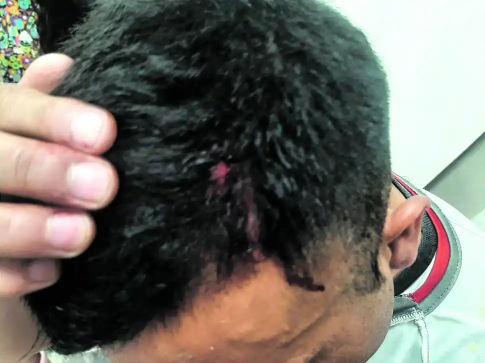 “Pensé que no iba a ver más a mi familia”, dijo un jugador de Sportivo Guzmán atacado por la hinchada de Atlético Concepción