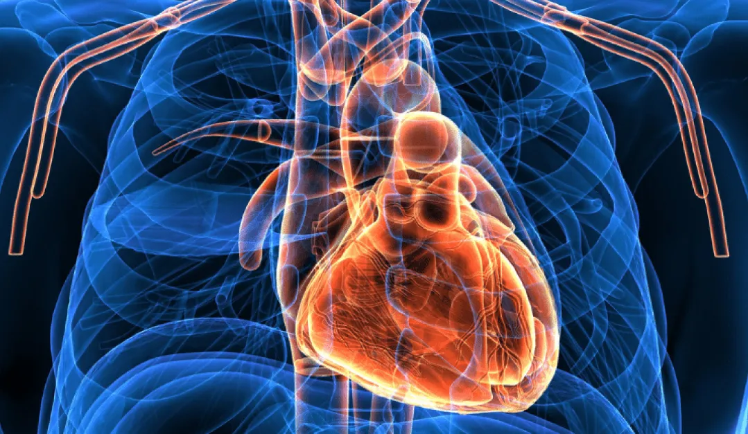 La insuficiencia cardíaca se produce por la incapacidad de nuestro corazón de bombear sangre. 