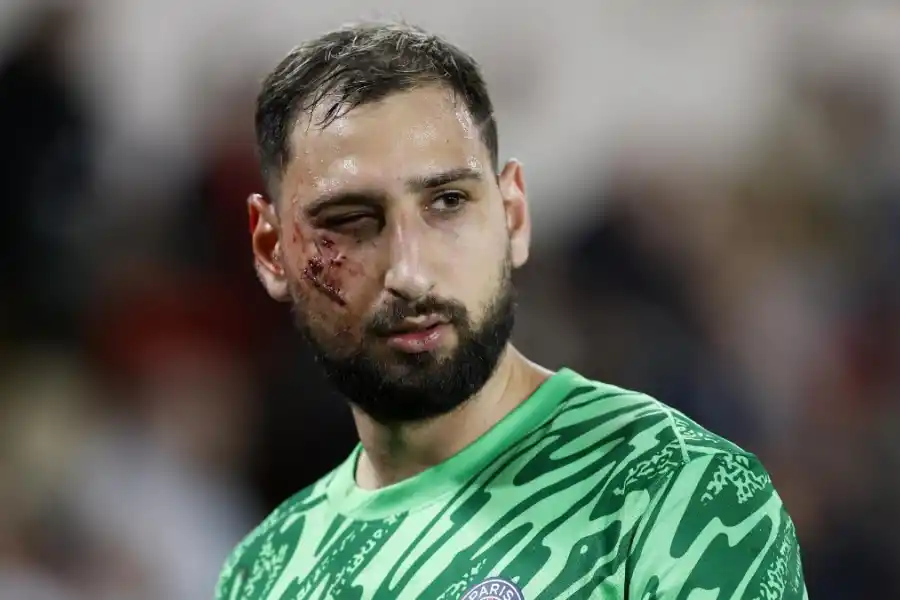 Le cerraron la herida con una abrochadora: las impactantes imágenes del rostro de Donnarumma tras recibir un planchazo
