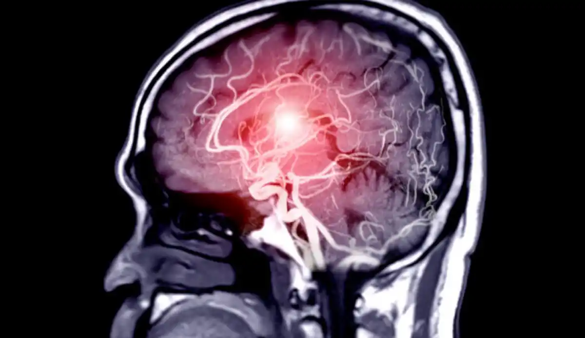 Las PAS pueden sufir de sobreestimulación.