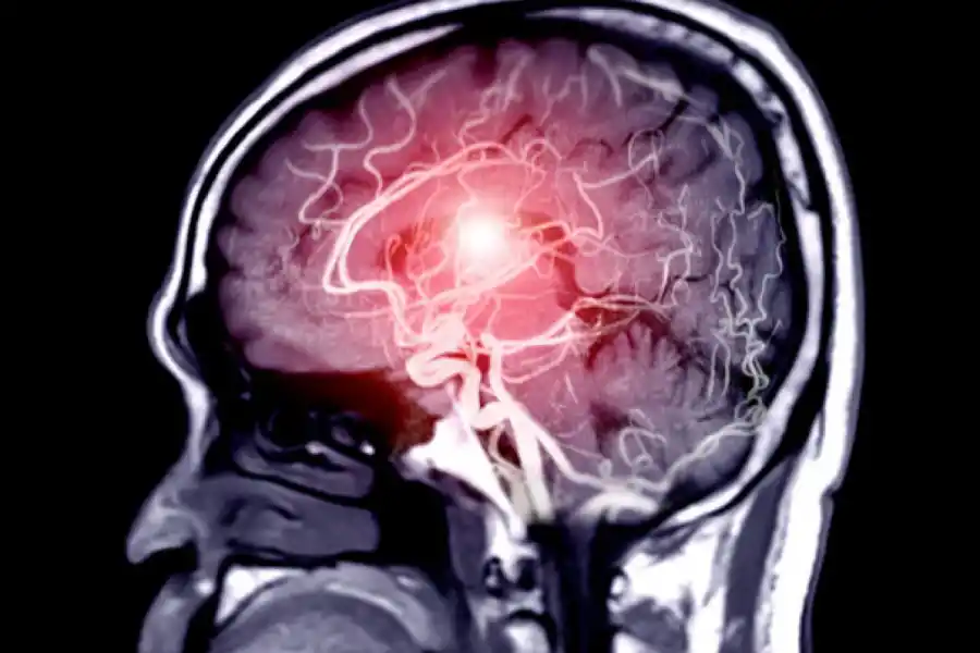 Las PAS pueden sufir de sobreestimulación.