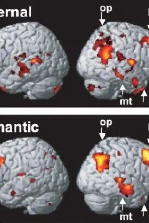 El amor romántico y el amor maternal producen los mismos efectos en el cerebro. 
