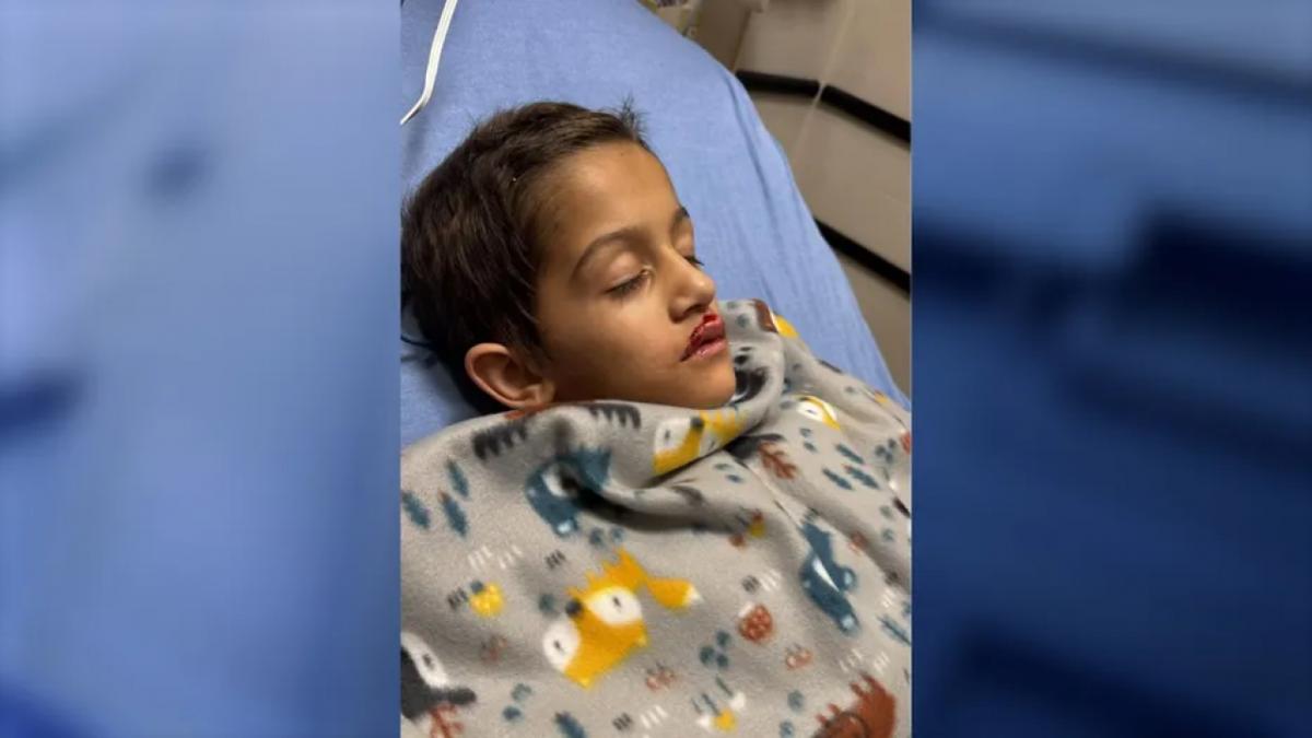 Alezander, de 7 años, se sometió a una cirugía a corazón abierto después de sufrir una lesión durante el espectáculo de drones de la ciudad de Orlando en el parque Lake Eola el sábado, dijeron sus padres. (Crédito: Adriana Edgerton)