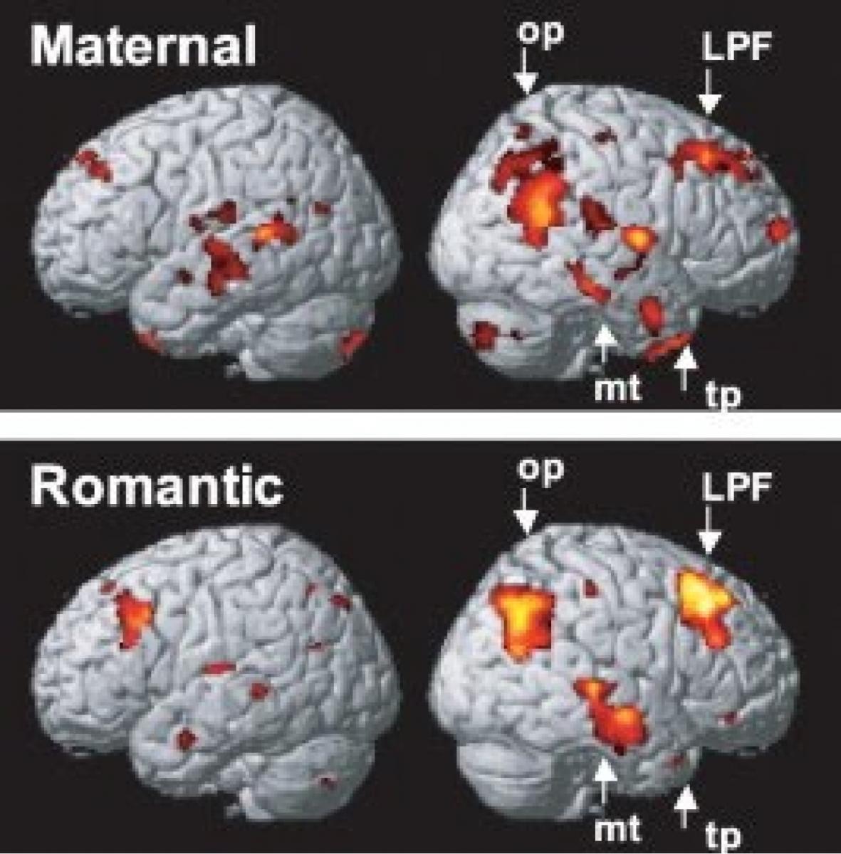 El amor romántico y el amor maternal producen los mismos efectos en el cerebro. 