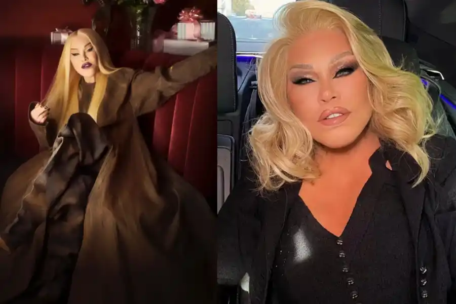Murió Jocelyn Wildenstein: la fascinante y trágica historia de la “mujer felina”