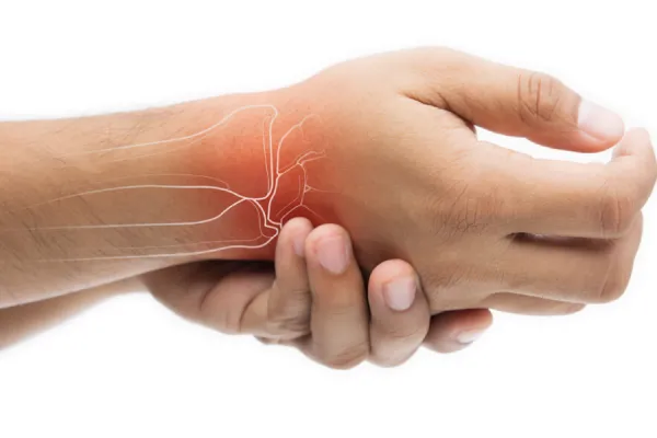 600x400_artritis-artrosis-diferencias-entre-ambas-enfermedades-1068017-113941.webp