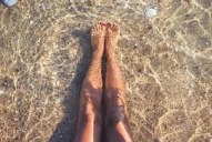 ¿Por qué las várices empeoran en el verano?