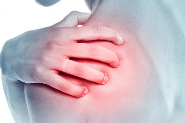 Síndrome del hombro congelado: qué es, síntomas y por qué aparece después de los 40